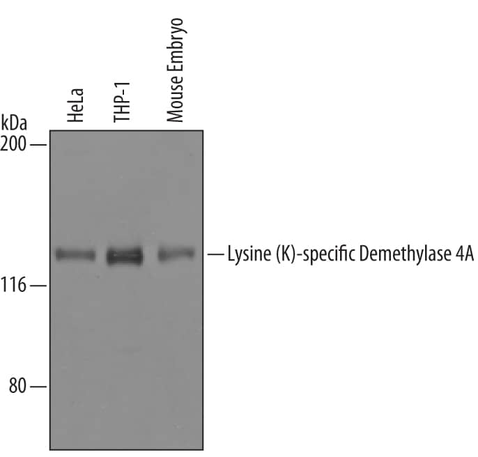 Western blot shows lysates of HeLa human cervical epithelial carcinoma cell line, THP-1 human acute monocytic leukemia cell line, and mouse embryo tissue. PVDF Membrane was probed with 1 µg/mL of Human Lysine (K)-specific Demethylase 4A/KDM4A Antigen Affinity-purified Polyclonal Antibody (Catalog # AF6434) followed by HRP-conjugated Anti-Sheep IgG Secondary Antibody (Catalog # HAF016). A specific band was detected for Lysine (K)-specific Demethylase 4A/KDM4A at approximately 120 kDa (as indicated). This experiment was conducted under reducing conditions and using Immunoblot Buffer Group 8.