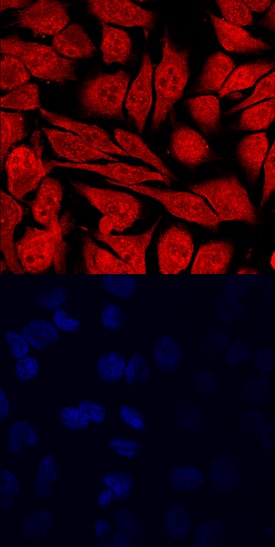 KDM4C was detected in immersion fixed HeLa human cervical epithelial carcinoma cell line using Human KDM4C Affinity-purified Polyclonal Antibody (Catalog # AF6430) at 10 µg/mL for 3 hours at room temperature. Cells were stained using the NorthernLights™ 557-conjugated Anti-Sheep IgG Secondary Antibody (red, upper panel; Catalog # NL010) and counterstained with DAPI (blue, lower panel). Specific staining was localized to nuclei and cytoplasm. View our protocol for Fluorescent ICC Staining of Cells on Coverslips.