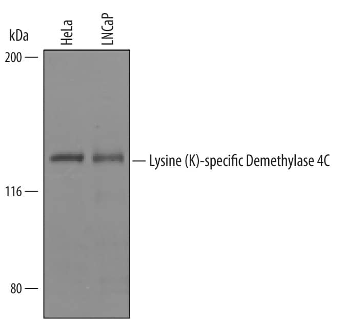 Western blot shows lysates of HeLa human cervical epithelial carcinoma cell line and LNCaP human prostate cancer cell line. PVDF Membrane was probed with 1 µg/mL of Human Lysine (K)-specific Demethylase 4C/KDM4C Antigen Affinity-purified Polyclonal Antibody (Catalog # AF6430) followed by HRP-conjugated Anti-Sheep IgG Secondary Antibody (Catalog # HAF016). A specific band was detected for Lysine (K)-specific Demethylase 4C/KDM4C at approximately 120 kDa (as indicated). This experiment was conducted under reducing conditions and using Immunoblot Buffer Group 8.