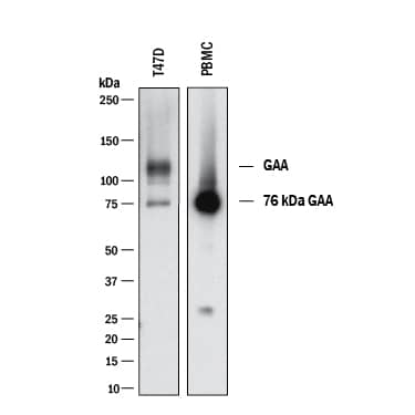 Western Blot LYAG/GAA Antibody (2489B) [Unconjugated]