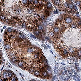 Immunohistochemistry LYAG/GAA Antibody (2489C) [Unconjugated]