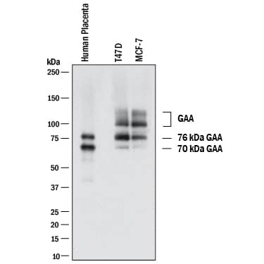 Western Blot LYAG/GAA Antibody (2489C) [Unconjugated]