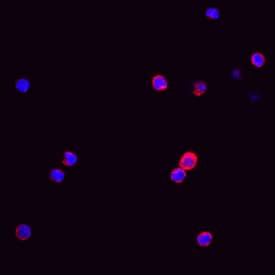 <b>Biological Strategies Validation. </b>M-CSF R/CD115 phosphorylated at Y723 was detected in immersion fixed human peripheral blood mononuclear cells (PBMCs) using Rabbit Anti-Human Phospho-M-CSF R/CD115 (Y723) Antigen Affinity-purified Polyclonal Antibody (Catalog # AF3268) at 10 µg/mL for 3 hours at room temperature. Cells were stained using the NorthernLights™ 557-conjugated Anti-Rabbit IgG Secondary Antibody (red; Catalog # NL004) and counterstained with DAPI (blue). View our protocol for Fluorescent ICC Staining of Non-adherent Cells.