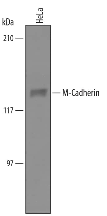 Western Blot M-Cadherin/Cadherin-15 Antibody [Unconjugated]
