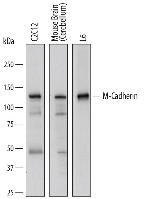 Western blot shows lysates of C2C12 mouse myoblast cell line, mouse brain (cerebellum) tissue, and L6 rat myoblast cell line. PVDF membrane was probed with 1 µg/mL of Sheep Anti-Mouse/Rat M-Cadherin/Cadherin-15 Antigen Affinity-purified Polyclonal Antibody (Catalog # AF7677) followed by HRP-conjugated Anti-Sheep IgG Secondary Antibody (Catalog # HAF016). A specific band was detected for M-Cadherin/Cadherin-15 at approximately 125 kDa (as indicated). This experiment was conducted under reducing conditions and using Immunoblot Buffer Group 1.