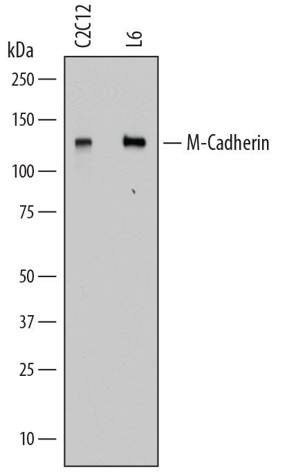 Western blot shows lysates of C2C12 mouse myoblast cell line and L6 rat myoblast cell line. PVDF membrane was probed with 2 µg/mL of Rat Anti-Mouse M-Cadherin/ Cadherin-15 Monoclonal Antibody (Catalog # MAB76771) followed by HRP-conjugated Anti-Rat IgG Secondary Antibody (Catalog # HAF005). A specific band was detected for M-Cadherin/Cadherin-15 at approximately 125 kDa (as indicated). This experiment was conducted under reducing conditions and using Immunoblot Buffer Group 1.