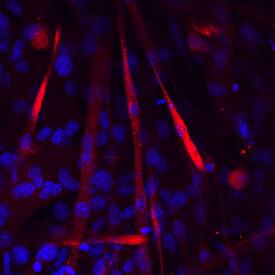 M-Cadherin/Cadherin-15 was detected in immersion fixed C2C12 mouse myoblast cells differentiated for 5 days with 5% equine serum using Rat Anti-Mouse M-Cadherin/Cadherin-15 Monoclonal Antibody (Catalog # MAB7677) at 10 µg/mL for 3 hours at room temperature. Cells were stained using the NorthernLights™ 557-conjugated Anti-Rat IgG Secondary Antibody (red; Catalog # NL013) and counterstained with DAPI (blue). Specific staining was localized to cytoplasm of developing myotubes. View our protocol for Fluorescent ICC Staining of Cells on Coverslips.
