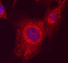 Immunocytochemistry MAGI2 Antibody