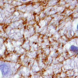 Immunohistochemistry MAGI2 Antibody