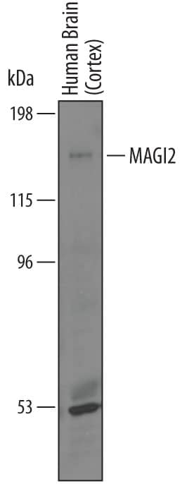 Western Blot MAGI2 Antibody