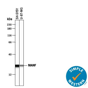 Simple Western lane view shows lysates of SH-SY5Y human neuroblastoma cell line and U-87 MG human glioblastoma/astrocytoma cell line, loaded at 0.2 mg/mL. A specific band was detected for MANF at approximately 24 kDa (as indicated) using 10 µg/mL of Goat Anti-Human MANF Antigen Affinity-purified Polyclonal Antibody (Catalog # AF3748) followed by 1:50 dilution of HRP-conjugated Anti-Goat IgG Secondary Antibody (Catalog # HAF109). This experiment was conducted under reducing conditions and using the 12-230 kDa separation system.