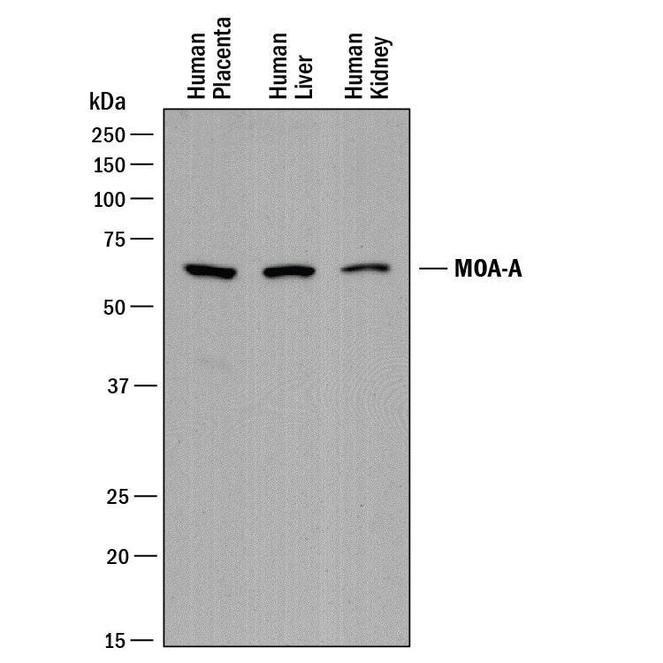 Western blot shows lysates of human placenta tissue, human liver tissue, and human kidney tissue. PVDF membrane was probed with 0.25 µg/mL of Sheep Anti-Human MAO-A Antigen Affinity-purified Polyclonal Antibody (Catalog # AF8247) followed by HRP-conjugated Anti-Sheep IgG Secondary Antibody (Catalog # HAF016). A specific band was detected for MAO-A at approximately 60-65 kDa (as indicated). This experiment was conducted under reducing conditions and using Immunoblot Buffer Group 1.