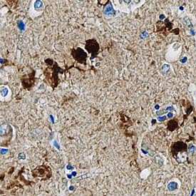 MAP2 was detected in immersion fixed paraffin-embedded sections of human Alzheimer's brain using Mouse Anti-Human MAP2 Monoclonal Antibody (Catalog # MAB8304) at 15 µg/mL overnight at 4 °C. Tissue was stained using the Anti-Mouse HRP-DAB Cell & Tissue Staining Kit (brown; Catalog # CTS002) and counterstained with hematoxylin (blue). Specific staining was localized to neurofibrillary tangles and plaques. View our protocol for Chromogenic IHC Staining of Paraffin-embedded Tissue Sections.