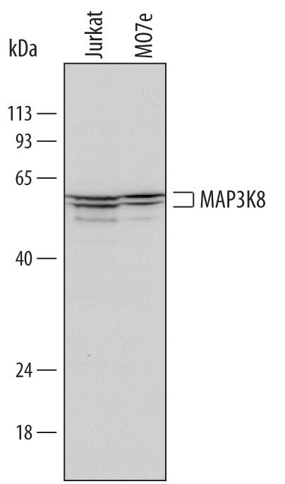 Western blot shows lysates of Jurkat human acute T cell leukemia cell line and MO7e human megakaryocytic leukemic cell line. PVDF Membrane was probed with 1 µg/mL of Human MAP3K8/Tpl2/COT Monoclonal Antibody (Catalog # MAB4586) followed by HRP-conjugated Anti-Mouse IgG Secondary Antibody (Catalog # HAF007). Specific bands were detected for MAP3K8/Tpl2/COT at approximately 58 and 52 kDa (as indicated). This experiment was conducted under reducing conditions and using Immunoblot Buffer Group 1.