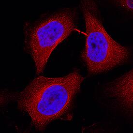 MASTL was detected in immersion fixed HeLa human cervical epithelial carcinoma cell line using Goat Anti-Human MASTL Antigen Affinity-purified Polyclonal Antibody (Catalog # AF10022) at 15 µg/mL for 3 hours at room temperature. Cells were stained using the NorthernLights™ 557-conjugated Anti-Goat IgG Secondary Antibody (red; Catalog # NL001) and counterstained with DAPI (blue). Specific staining was localized to cytoplasm. View our protocol for Fluorescent ICC Staining of Cells on Coverslips.