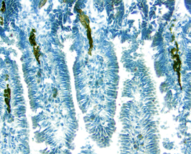 MAdCAM-1 was detected in perfusion fixed frozen sections of mouse intestine using Goat Anti-Mouse MAdCAM-1 Antigen Affinity-purified Polyclonal Antibody (Catalog # AF993) at 1.7 µg/mL overnight at 4 °C. Tissue was stained using the Anti-Goat HRP-DAB Cell & Tissue Staining Kit (brown; Catalog # CTS008) and counterstained with hematoxylin (blue). Specific labeling was localized to the endothelial cells of blood capillaries in intestinal villi. View our protocol for Chromogenic IHC Staining of Frozen Tissue Sections.