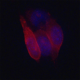 MCAM/CD146 was detected in immersion fixed B16-F1 mouse melanoma cell line using Sheep Anti-Mouse MCAM/CD146 Antigen Affinity-purified Polyclonal Antibody (Catalog # AF6106) at 1.7 µg/mL for 3 hours at room temperature. Cells were stained using the NorthernLights™ 557-conjugated Anti-Sheep IgG Secondary Antibody (red; Catalog # NL010) and counterstained with DAPI (blue). Specific staining was localized to plasma membranes. View our protocol for Fluorescent ICC Staining of Cells on Coverslips.