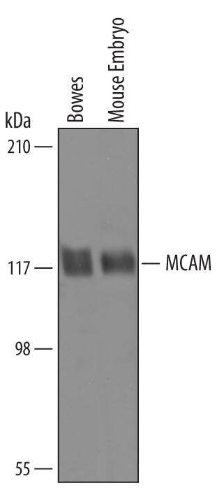 Western blot shows lysates of Bowes human melanoma cell line and mouse embryo tissue. PVDF Membrane was probed with 1 µg/mL of Sheep Anti-Mouse MCAM/CD146 Antigen Affinity-purified Polyclonal Antibody (Catalog # AF6106) followed by HRP-conjugated Anti-Sheep IgG Secondary Antibody (Catalog # HAF016). A specific band was detected for MCAM/CD146 at approximately 117 kDa (as indicated). This experiment was conducted under reducing conditions and using Immunoblot Buffer Group 8.