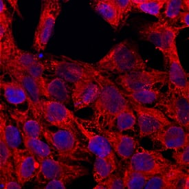 MCAM/CD146 was detected in immersion fixed BG01V human embryonic stem cells using Goat Anti-Human MCAM/CD146 Antigen Affinity-purified Polyclonal Antibody (Catalog # AF932) at 10 µg/mL for 3 hours at room temperature. Cells were stained using the Northern-Lights™ 557-conjugated Anti-Goat IgG Secondary Antibody (red; Catalog # NL001) and counterstained with DAPI (blue). Specific staining was localized to cell membranes and cytoplasm. View our protocol for Fluorescent ICC Staining of Stem Cells on Coverslips.