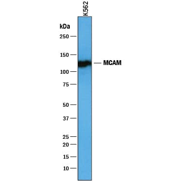 Western blot shows lysates of K562 human chronic myelogenous leukemia cell line. PVDF membrane was probed with 1 µg/mL of Goat Anti-Human MCAM/CD146 Antigen Affinity-purified Polyclonal Antibody (Catalog # AF932) followed by HRP-conjugated Anti-Goat IgG Secondary Antibody (Catalog # HAF019). A specific band was detected for MCAM/CD146 at approximately 117 kDa (as indicated). This experiment was conducted under reducing conditions and using Immunoblot Buffer Group 1.