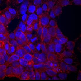 MCAM/CD146 was detected in immersion fixed BG01V human embryonic stem cells using Mouse Anti-Human MCAM/CD146 Monoclonal Antibody (Catalog # MAB932) at 10 µg/mL for 3 hours at room temperature. Cells were stained using the NorthernLights™ 557-conjugated Anti-Mouse IgG Secondary Antibody (red; Catalog # NL007) and counterstained with DAPI (blue). Specific staining was localized to cell membranes and cytoplasm. View our protocol for Fluorescent ICC Staining of Stem Cells on Coverslips.