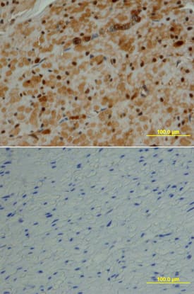 MCM2 was detected in immersion fixed paraffin-embedded sections of human colon array using Goat Anti-Human/Mouse MCM2 Antigen Affinity-purified Polyclonal Antibody (Catalog # AF5778) at 10 µg/mL overnight at 4 °C. Tissue was stained using the Anti-Goat HRP-DAB Cell & Tissue Staining Kit (brown; Catalog # CTS008) and counterstained with hematoxylin (blue). Lower panel shows a lack of labeling if primary antibodies are omitted and tissue is stained only with secondary antibody followed by incubation with detection reagents. View our protocol for Chromogenic IHC Staining of Paraffin-embedded Tissue Sections.