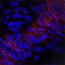 M-Cadherin/Cadherin-15 was detected in perfusion fixed frozen sections of human embryonic muscle using Sheep Anti-Mouse/Rat M-Cadherin/Cadherin-15 Antigen Affinity-purified Polyclonal Antibody (Catalog # AF7677) at 1.7 µg/mL overnight at 4 °C. Tissue was stained using the NorthernLights™ 557-conjugated Anti-Sheep IgG Secondary Antibody (red; Catalog # NL010) and counterstained with DAPI (blue). Specific staining was localized to plasma membrane. View our protocol for Fluorescent IHC Staining of Frozen Tissue Sections.