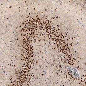 MEF2C was detected in immersion fixed paraffin-embedded sections of human brain (hippocampus) using Sheep Anti-Human/ Mouse MEF2C Antigen Affinity-purified Polyclonal Antibody (Catalog # AF6786) at 5 µg/mL overnight at 4 °C. Tissue was stained using the Anti-Sheep HRP-DAB Cell & Tissue Staining Kit (brown; CTS019) and counterstained with hematoxylin (blue). Specific staining was localized to neuronal nuclei. View our protocol for Chromogenic IHC Staining of Paraffin-embedded Tissue Sections.