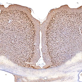 MEF2C was detected in perfusion fixed frozen sections of mouse brain (cortex) using Sheep Anti-Human/Mouse MEF2C Antigen Affinity-purified Polyclonal Antibody (Catalog # AF6786) at 1 µg/mL overnight at 4 °C. Tissue was stained using the Anti-Sheep HRP-DAB Cell & Tissue Staining Kit (brown; CTS019) and counterstained with hematoxylin (blue). Specific staining was localized to neuronal nuclei. View our protocol for Chromogenic IHC Staining of Frozen Tissue Sections.