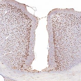 MEF2C was detected in immersion fixed paraffin-embedded sections of human brain (cortex) using Mouse Anti-Human/Mouse MEF2C Monoclonal Antibody (Catalog # MAB6786) at 5 µg/mL for 1 hour at room temperature followed by incubation with the Anti-Mouse IgG VisUCyte™ HRP Polymer Antibody (Catalog # VC001). Tissue was stained using DAB (brown) and counterstained with hematoxylin (blue). Specific staining was localized to neuronal nuclei. View our protocol for IHC Staining with VisUCyte HRP Polymer Detection Reagents.