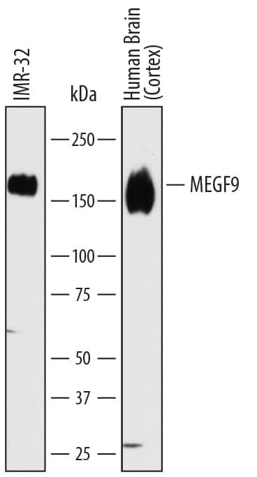 Western blot shows lysates of IMR-32 human neuroblastoma cell line and human brain (cortex) tissue. PVDF membrane was probed with 1 µg/mL of Sheep Anti-Human MEGF9 Antigen Affinity-purified Polyclonal Antibody (Catalog # AF7768) followed by HRP-conjugated Anti-Sheep IgG Secondary Antibody (Catalog # <a class=
