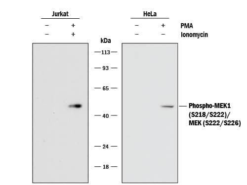 Western blot shows lysates of Jurkat human acute T cell leukemia cell line and HeLa human cervical epithelial carcinoma cell line untreated (-) or treated (+) with 200 nM PMA or PMA and Ionomycin for 20 minutes. PVDF membrane was probed with 0.5 µg/mL of Rabbit Anti-Human/Mouse/Rat Phospho-MEK1 (S218/S222)/ MEK2 (S222/S226) Monoclonal Antibody (Catalog # MAB8407) followed by HRP-conjugated Anti-Rabbit IgG Secondary Antibody (Catalog # HAF008). A specific band was detected for Phospho-MEK1 (S218/S222)/ MEK2 (S222/S226) at approximately 50 kDa (as indicated). This experiment was conducted under reducing conditions and using Immunoblot Buffer Group 1.
