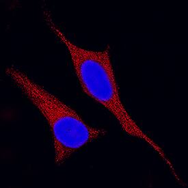 MEK2 was detected in immersion fixed HeLa human cervical epithelial carcinoma cell line using Mouse Anti-Human/Mouse/Rat MEK2 Monoclonal Antibody (Catalog # MAB2855) at 25 µg/mL for 3 hours at room temperature. Cells were stained using the NorthernLights™ 557-conjugated Anti-Mouse IgG Secondary Antibody (red; Catalog # NL007) and counterstained with DAPI (blue). Specific staining was localized to cytoplasm. View our protocol for Fluorescent ICC Staining of Cells on Coverslips.