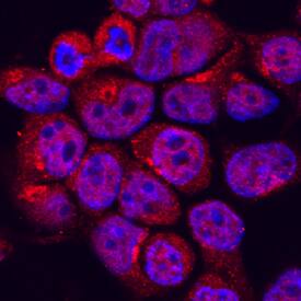 Immunocytochemistry MEKK2 Antibody (722728)
