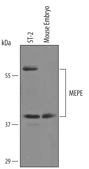 Western Blot MEPE/OF45 Antibody