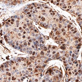 Immunohistochemistry MERIT40/HSPC142 Antibody