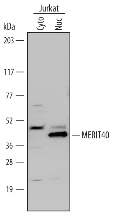 Western Blot MERIT40/HSPC142 Antibody