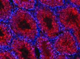 Immunohistochemistry MESDC2 Antibody [Unconjugated]