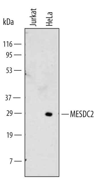 Western Blot MESDC2 Antibody (513802)