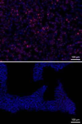 <b>Biological Strategies Validation. </b>MESP1 was detected in fixed H1 human embryonic stem cells untreated (lower panel) or treated (upper panel) with Doxycycline using Rabbit Anti-Human MESP1 Monoclonal Antibody (Catalog # MAB9219). Cells were stained using anti-rabbit IgG secondary antibody (red) and counterstained with DAPI (blue).Image provided courtesy of Michael Kyba's lab, University of Minnesota.
