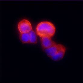 N-Acetylglucosaminyltransferase V/MGAT5 was detected in immersion fixed MCF-7 human breast cancer cell line using Mouse Anti-Human N-Acetylglucosaminyltransferase V/MGAT5 Monoclonal Antibody (Catalog # MAB5469) at 25 µg/mL for 3 hours at room temperature. Cells were stained using the NorthernLights™ 557-conjugated Anti-Mouse IgG Secondary Antibody (red; Catalog # NL007) and counterstained with DAPI (blue). Specific staining was localized to plasma membranes and cytoplasm. View our protocol for Fluorescent ICC Staining of Cells on Coverslips.