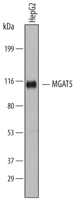 Western Blot N-Acetylglucosaminyltransferase V/MGAT5 Antibody (706824)
