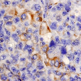 Immunohistochemistry MIA Antibody