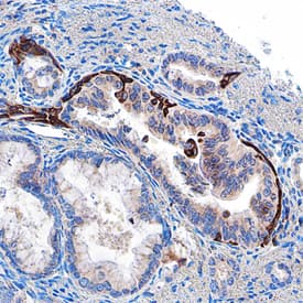 MICA/B was detected in immersion fixed paraffin-embedded sections of human pancreas using Mouse Anti-Human MICA/B Monoclonal Antibody (Catalog # MAB13001) at 15 µg/mL overnight at 4 °C. Before incubation with the primary antibody, tissue was subjected to heat-induced epitope retrieval using Antigen Retrieval Reagent-Basic (Catalog # CTS013). Tissue was stained using the Anti-Mouse HRP-DAB Cell & Tissue Staining Kit (brown; Catalog # CTS002) and counterstained with hematoxylin (blue). Specific staining was localized to exocrine cells. View our protocol for Chromogenic IHC Staining of Paraffin-embedded Tissue Sections.