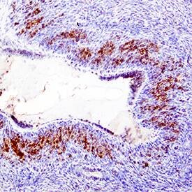 MIF was detected in immersion fixed paraffin-embedded sections of human ovary using Mouse Anti-Human/ Mouse MIF Monoclonal Antibody (Catalog # MAB2892) at 15 µg/mL overnight at 4 °C. Tissue was stained using the Anti-Mouse HRP-DAB Cell & Tissue Staining Kit (brown; Catalog # CTS002) and counterstained with hematoxylin (blue). Specific staining was localized to epithelial cells. View our protocol for Chromogenic IHC Staining of Paraffin-embedded Tissue Sections.