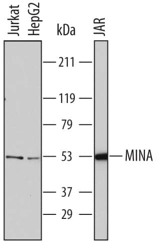 Western blot shows lysates of Jurkat human acute T cell leukemia cell line, HepG2 human hepatocellular carcinoma cell line, and JAR human choriocarcinoma cell line. PVDF membrane was probed with 2 µg/mL of Mouse Anti-Human MINA Monoclonal Antibody (Catalog # MAB7476) followed by HRP-conjugated Anti-Mouse IgG Secondary Antibody (Catalog # HAF007). A specific band was detected for MINA at approximately 53 kDa (as indicated). This experiment was conducted under reducing conditions and using Immunoblot Buffer Group 1.