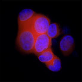 MIS/AMH was detected in immersion fixed LNCaP human prostate cancer cell line using Mouse Anti-Human MIS/AMH Monoclonal Antibody (Catalog # MAB17371) at 25 µg/mL for 3 hours at room temperature. Cells were stained using the NorthernLights™ 557-conjugated Anti-Mouse IgG Secondary Antibody (red; Catalog # NL007) and counterstained with DAPI (blue). Specific staining was localized to cytoplasm. View our protocol for Fluorescent ICC Staining of Cells on Coverslips.