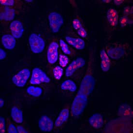 Ki67/MKI67 was detected in immersion fixed A549 human lung carcinoma cell line using Sheep Anti-Human Ki67/MKI67 Antigen Affinity-purified Polyclonal Antibody (Catalog # AF7617) at 5 µg/mL for 3 hours at room temperature. Cells were stained using the Northern-Lights™ 557-conjugated Anti-Sheep IgG Secondary Antibody (red; NL010) and counterstained with DAPI (blue). Specific staining was localized to nuclei and nucleoli. View our protocol for Fluorescent ICC Staining of Cells on Coverslips.