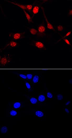Ki67/MKI67 was detected in immersion fixed NIH-3T3 mouse embryonic fibroblast cell line using Sheep Anti-Mouse Ki67/MKI67 Antigen Affinity-purified Polyclonal Antibody (Catalog # AF7649) at 10 µg/mL for 3 hours at room temperature. Cells were stained using the NorthernLights™ 557-conjugated Anti-Sheep IgG Secondary Antibody (red, upper panel; Catalog # NL010) and counterstained with DAPI (blue, lower panel). Specific staining was localized to nuclei and nucleoli. View our protocol for Fluorescent ICC Staining of Cells on Coverslips.