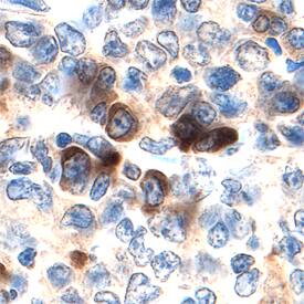 MKK7 was detected in immersion fixed paraffin-embedded sections of human tonsil using Mouse Anti-Human MKK7 Monoclonal Antibody (Catalog # MAB3579) at 10 µg/mL overnight at 4 °C. Before incubation with the primary antibody tissue was subjected to heat-induced epitope retrieval using Antigen Retrieval Reagent-Basic (Catalog # CTS013). Tissue was stained using the Anti-Goat HRP-DAB Cell & Tissue Staining Kit (brown; Catalog # CTS008) and counterstained with hematoxylin (blue). View our protocol for Chromogenic IHC Staining of Paraffin-embedded Tissue Sections.